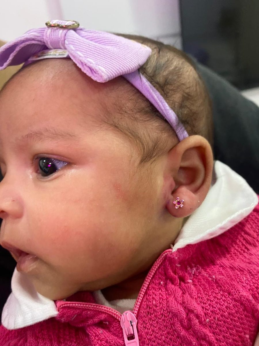 Bebê com furo de orelha humanizado e brinco de joia rosa em formato de flor feito por enfermeira na Luquini Clinic, Rio de Janeiro
